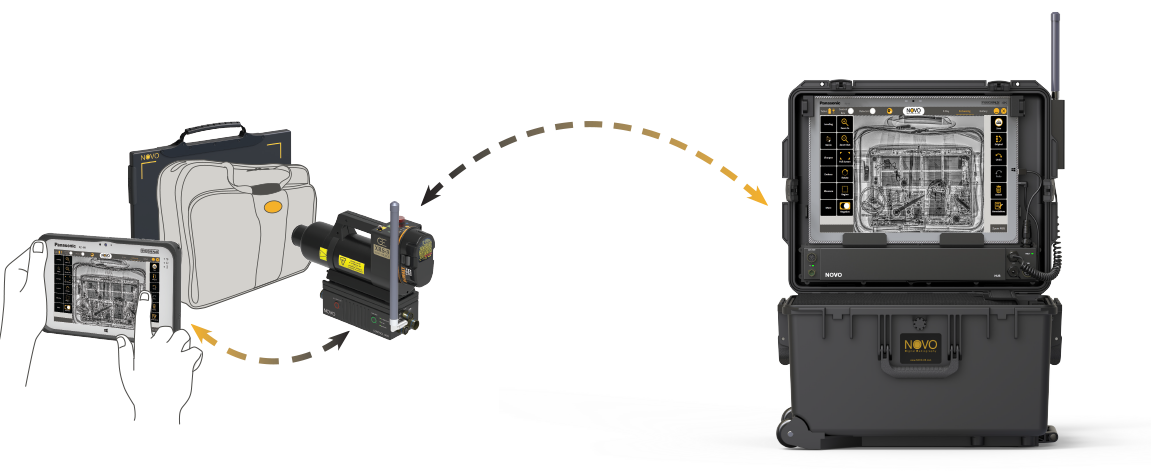 NOVO Digital Radiography portable X-ray systems - ZNZ